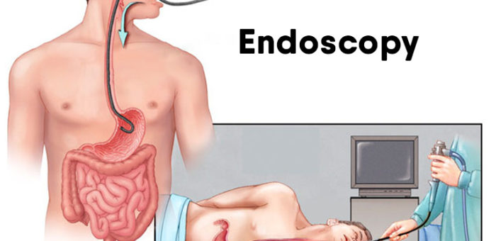 Endoscopy Unit